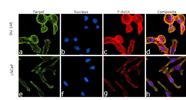 Alpha Actinin 4 Antibody in Immunocytochemistry (ICC/IF)