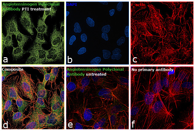 Angiotensinogen Antibody in Immunocytochemistry (ICC/IF)