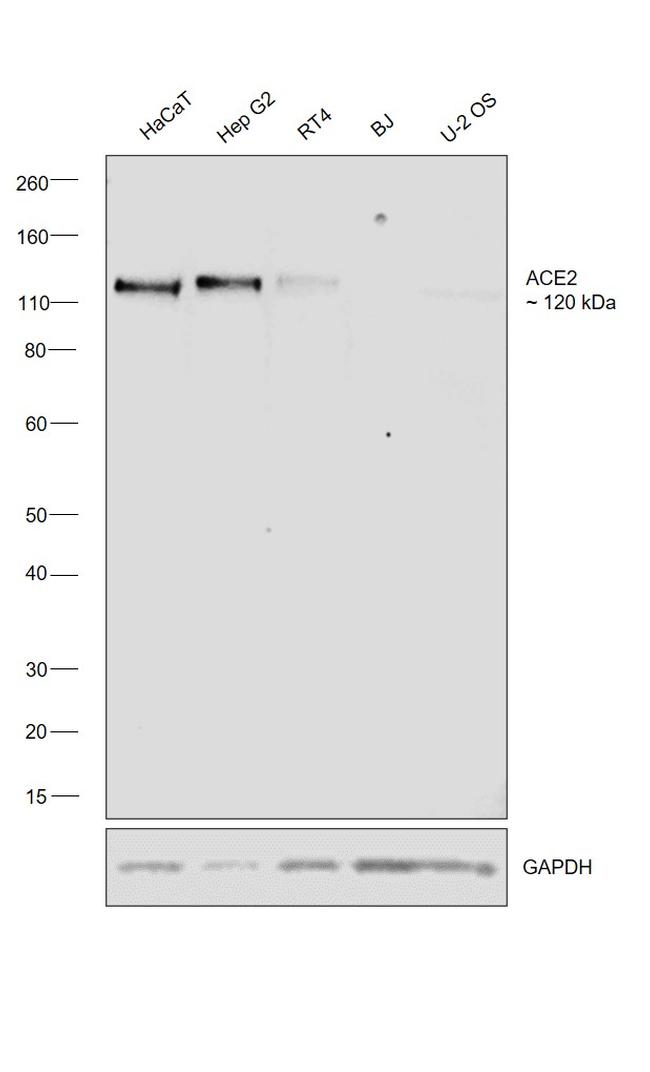 ACE2 Antibody in Western Blot (WB)