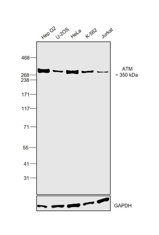 ATM Antibody in Western Blot (WB)