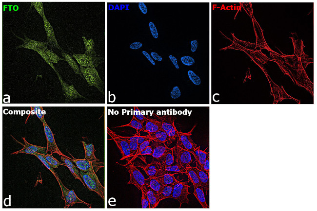 FTO Antibody in Immunocytochemistry (ICC/IF)