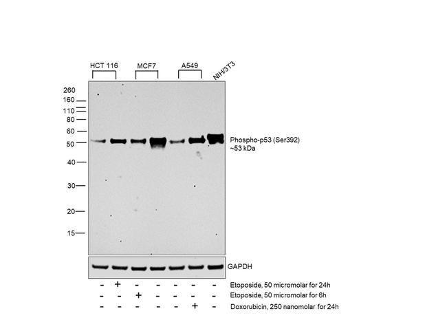 Phospho-p53 (Ser392) Antibody in Western Blot (WB)