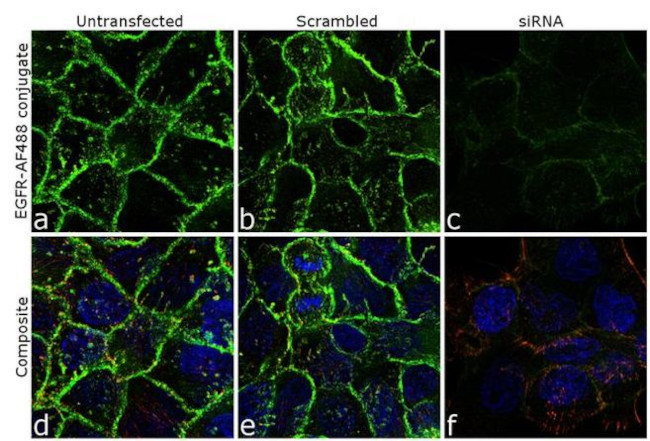 EGFR Antibody in Immunocytochemistry (ICC/IF)