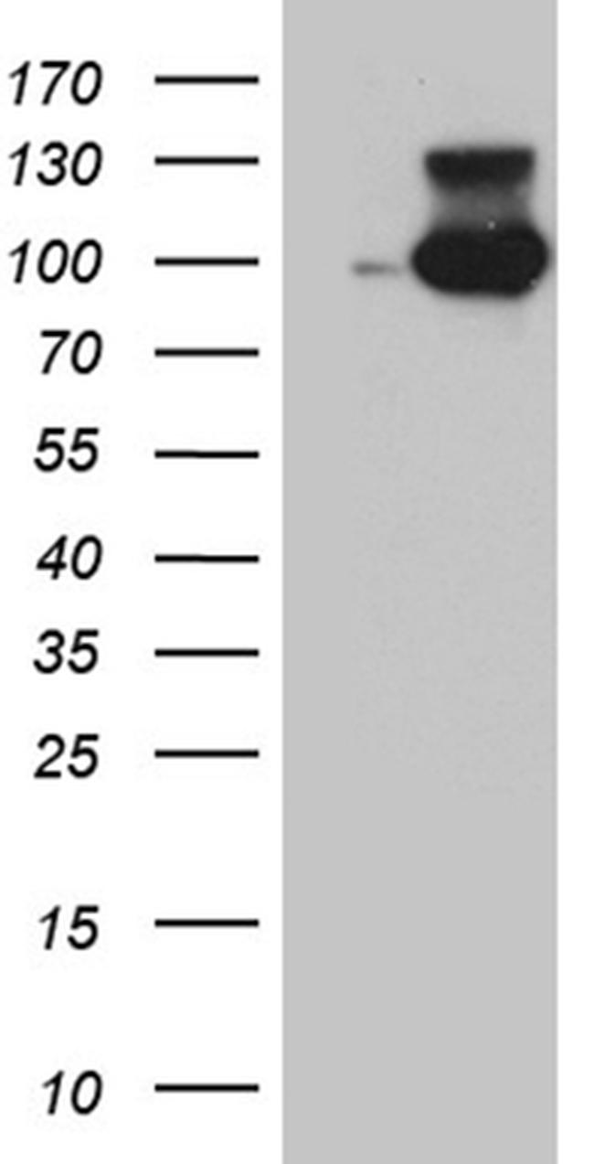 MALT1 Antibody in Western Blot (WB)