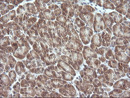 MAP2K3 Antibody in Immunohistochemistry (Paraffin) (IHC (P))