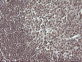 MAP2K3 Antibody in Immunohistochemistry (Paraffin) (IHC (P))