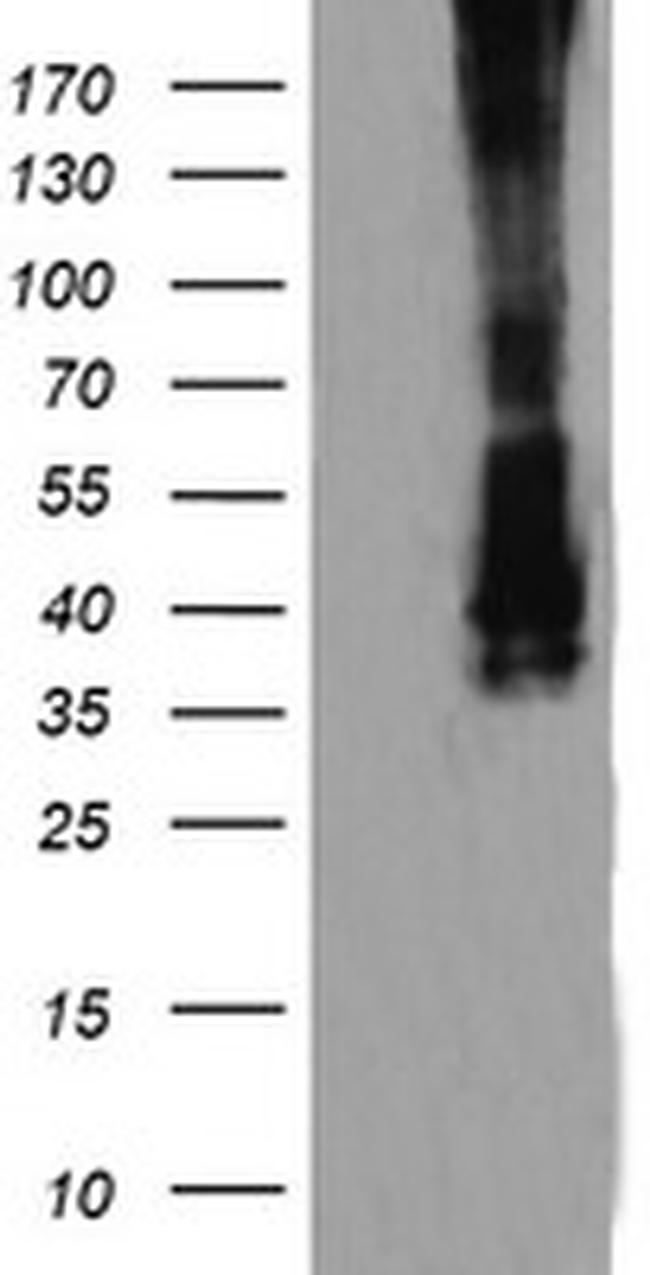 MAP2K3 Antibody in Western Blot (WB)