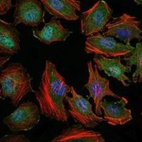 ASK1 Antibody in Immunocytochemistry (ICC/IF)