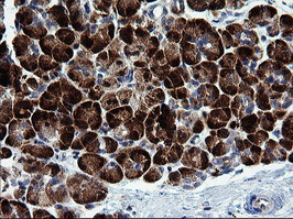 MAPK9 Antibody in Immunohistochemistry (Paraffin) (IHC (P))