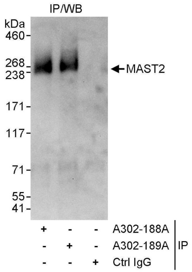 MAST2 Antibody in Immunoprecipitation (IP)