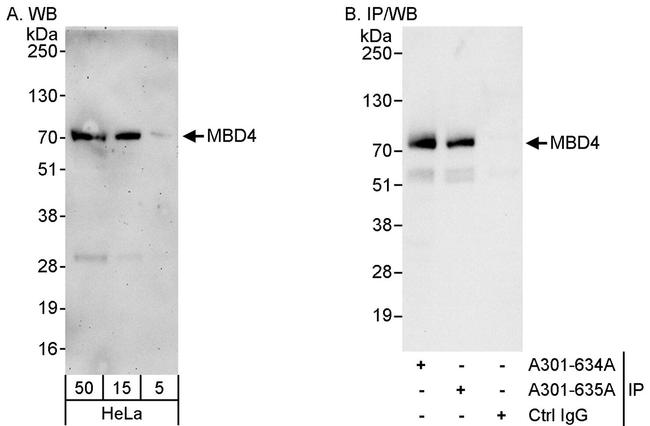 MBD4 Antibody in Western Blot (WB)