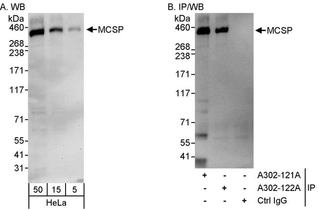 MCSP Antibody in Western Blot (WB)