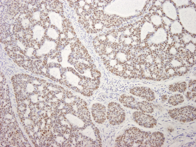 MDC1 Antibody in Immunohistochemistry (IHC)