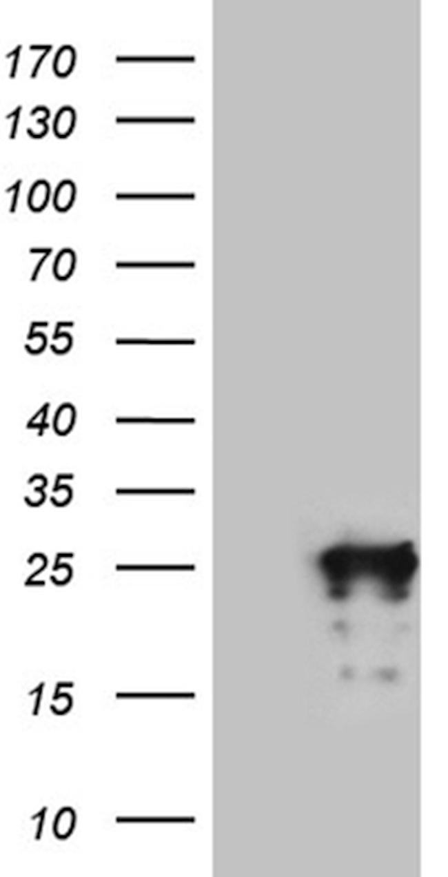 MED19 Antibody in Western Blot (WB)