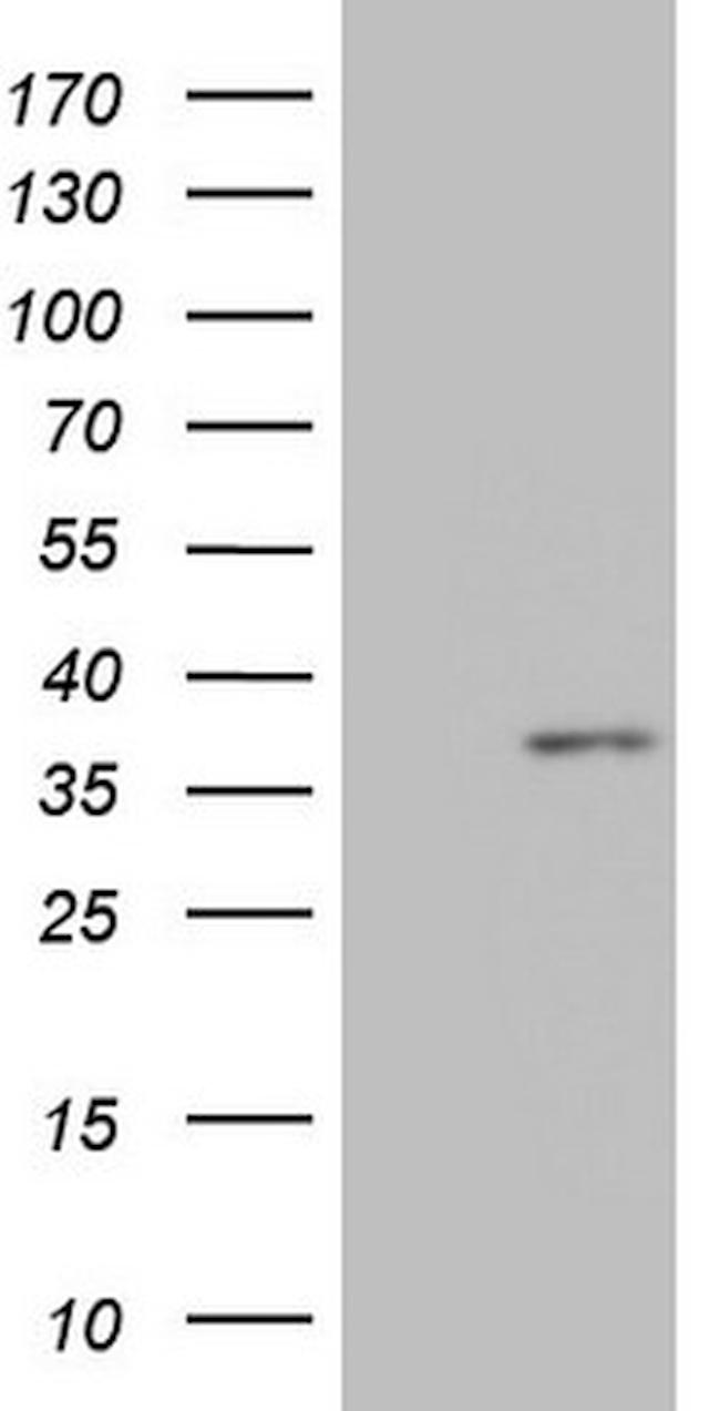 MED6 Antibody in Western Blot (WB)