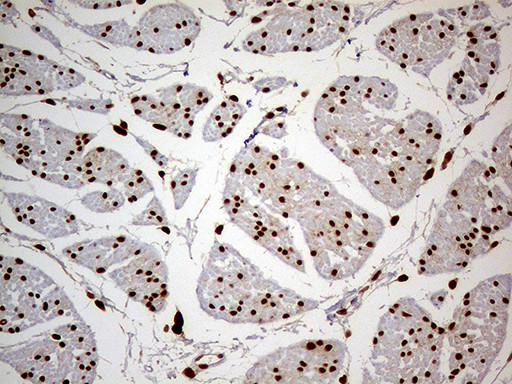 MEIS1 Antibody in Immunohistochemistry (Paraffin) (IHC (P))