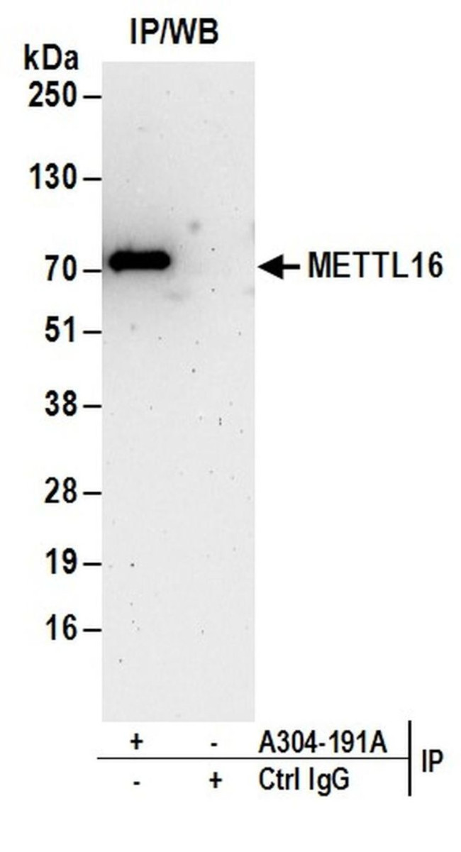 METTL16 Antibody in Immunoprecipitation (IP)