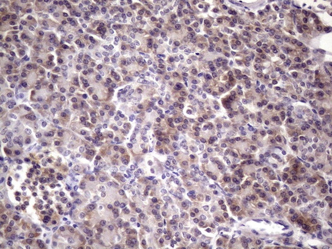 MGC12965 Antibody in Immunohistochemistry (Paraffin) (IHC (P))