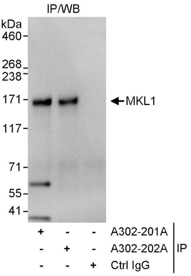 MKL1 Antibody in Immunoprecipitation (IP)