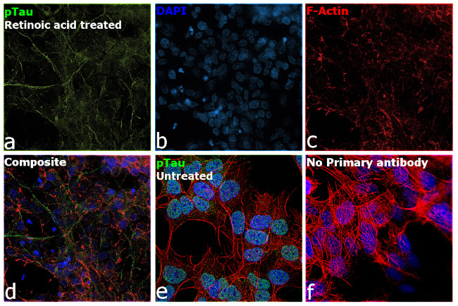 Phospho-Tau (Ser202, Thr205) Antibody in Immunocytochemistry (ICC/IF)