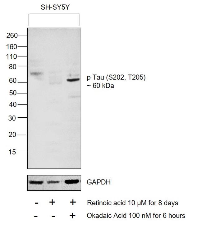 Phospho-Tau (Ser202, Thr205) Antibody in Western Blot (WB)