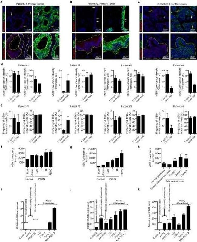 Musashi-1 Antibody in Immunohistochemistry (Paraffin) (IHC (P))