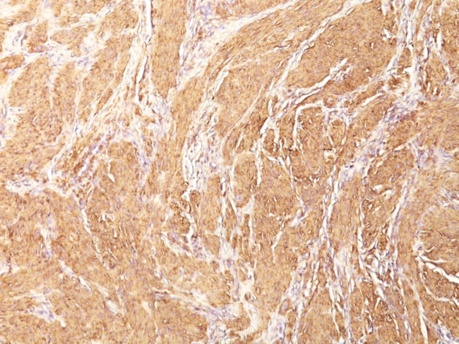 Actin, Muscle Specific (Muscle Cell Marker) Antibody in Immunohistochemistry (Paraffin) (IHC (P))