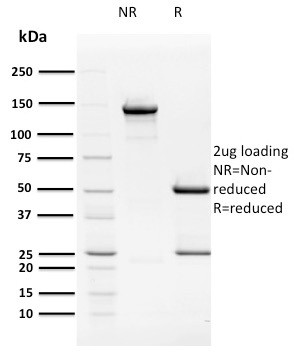 HPV16 E2 (Human Papilloma Virus 16) Antibody in SDS-PAGE (SDS-PAGE)