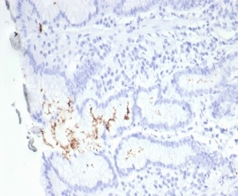 Helicobacter pylori (Catalase) Antibody in Immunohistochemistry (Paraffin) (IHC (P))