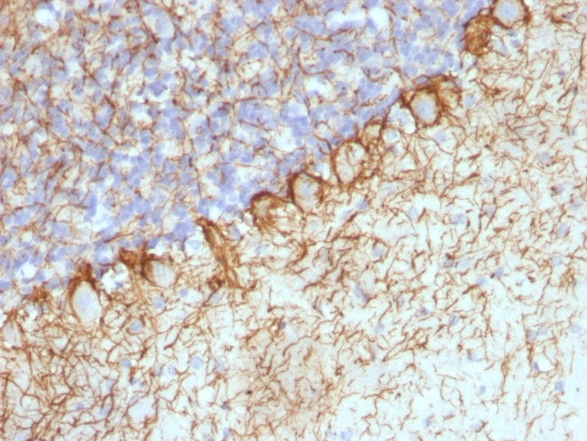 Neurofilament (H+L) (Neuronal Marker) Antibody in Immunohistochemistry (Paraffin) (IHC (P))