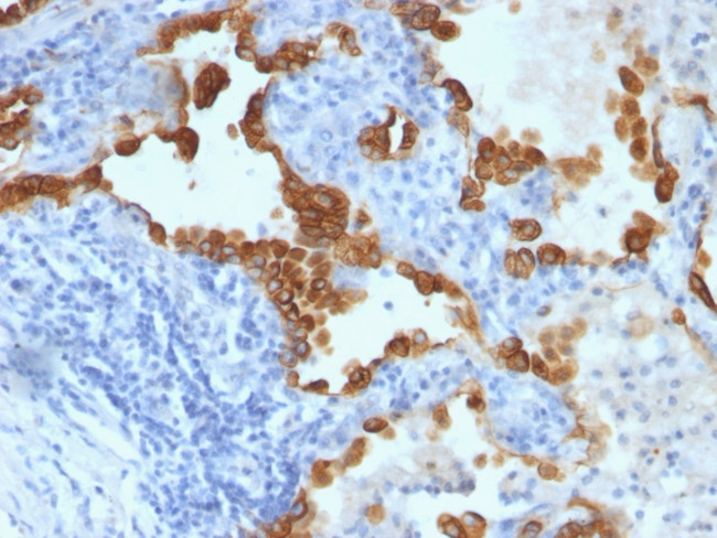 Cytokeratin 8/18 Antibody in Immunohistochemistry (Paraffin) (IHC (P))