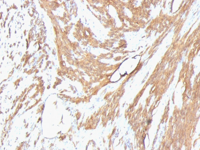 Actin, Muscle Specific (Muscle Cell Marker) Antibody in Immunohistochemistry (Paraffin) (IHC (P))