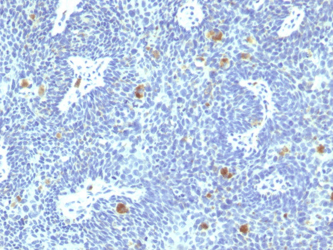 HPV-16 (Human Papilloma Virus 16) Antibody in Immunohistochemistry (Paraffin) (IHC (P))