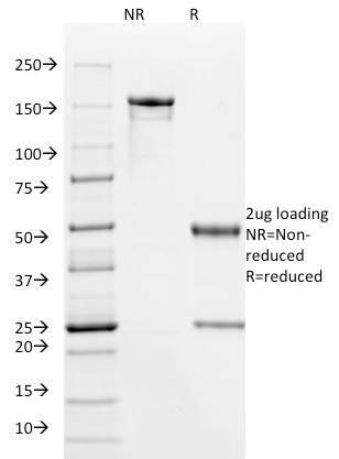 HPV-16 (Human Papilloma Virus 16) Antibody in SDS-PAGE (SDS-PAGE)