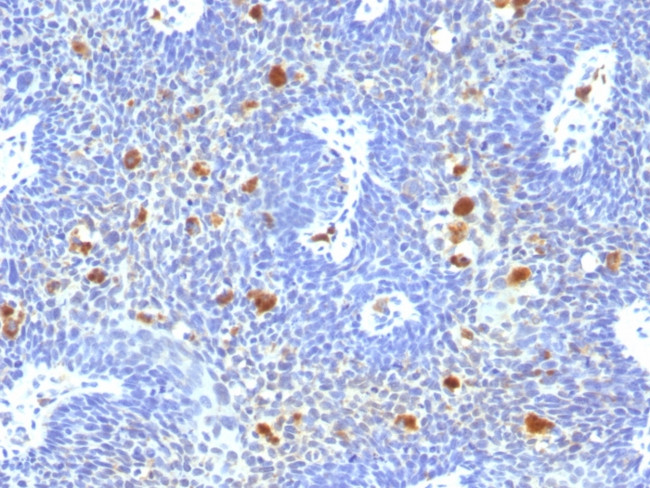 HPV-16 (Human Papilloma Virus 16) Antibody in Immunohistochemistry (Paraffin) (IHC (P))