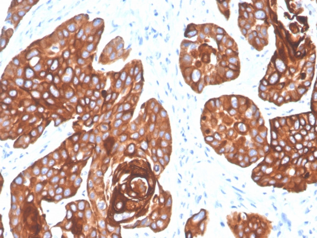 Cytokeratin 5/6 (Basal, Myoepithelial and Mesothelial Cell Marker) Antibody in Immunohistochemistry (Paraffin) (IHC (P))