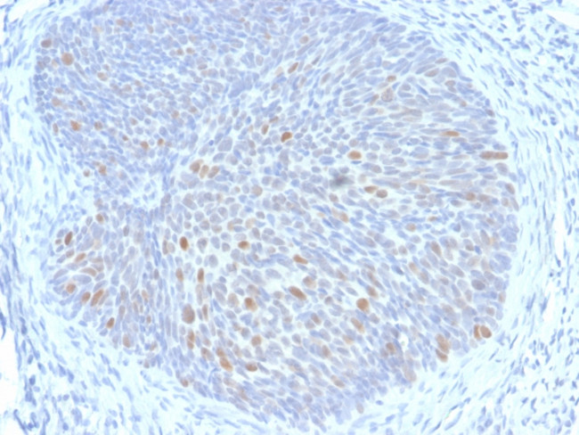 HPV16 E1/E4 (Human Papilloma Virus 16) Antibody in Immunohistochemistry (Paraffin) (IHC (P))