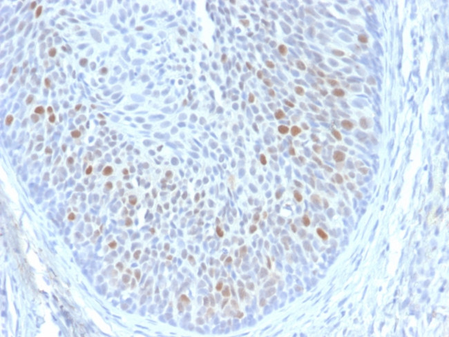 HPV16 E1/E4 (Human Papilloma Virus 16) Antibody in Immunohistochemistry (Paraffin) (IHC (P))