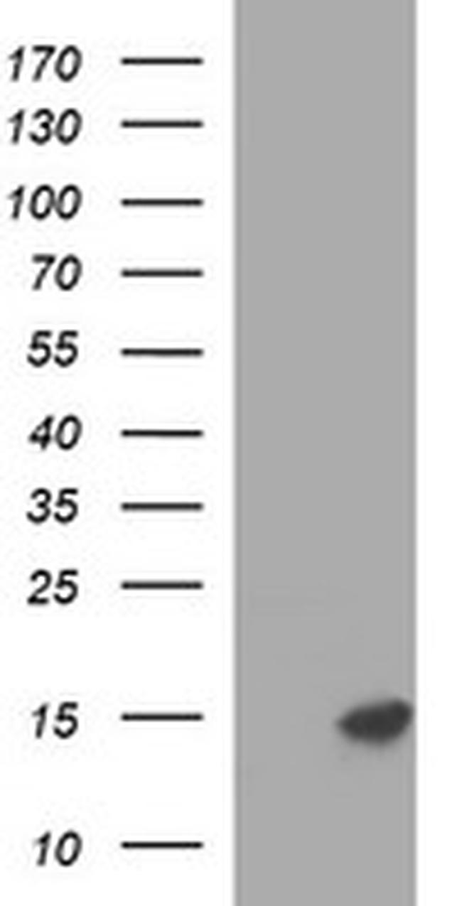 MSMB Antibody in Western Blot (WB)