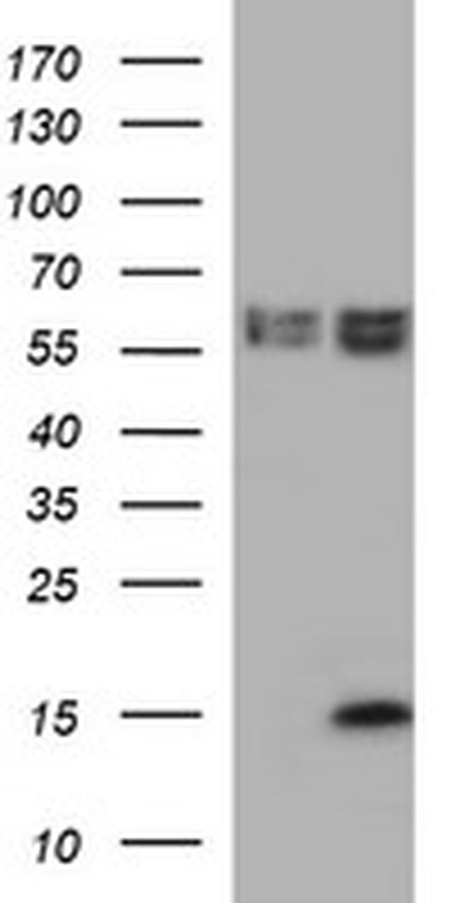 MSMB Antibody in Western Blot (WB)