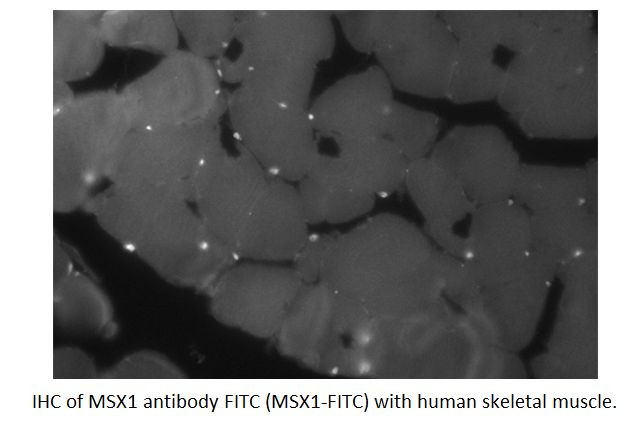 MSX1 Antibody in Immunohistochemistry (IHC)