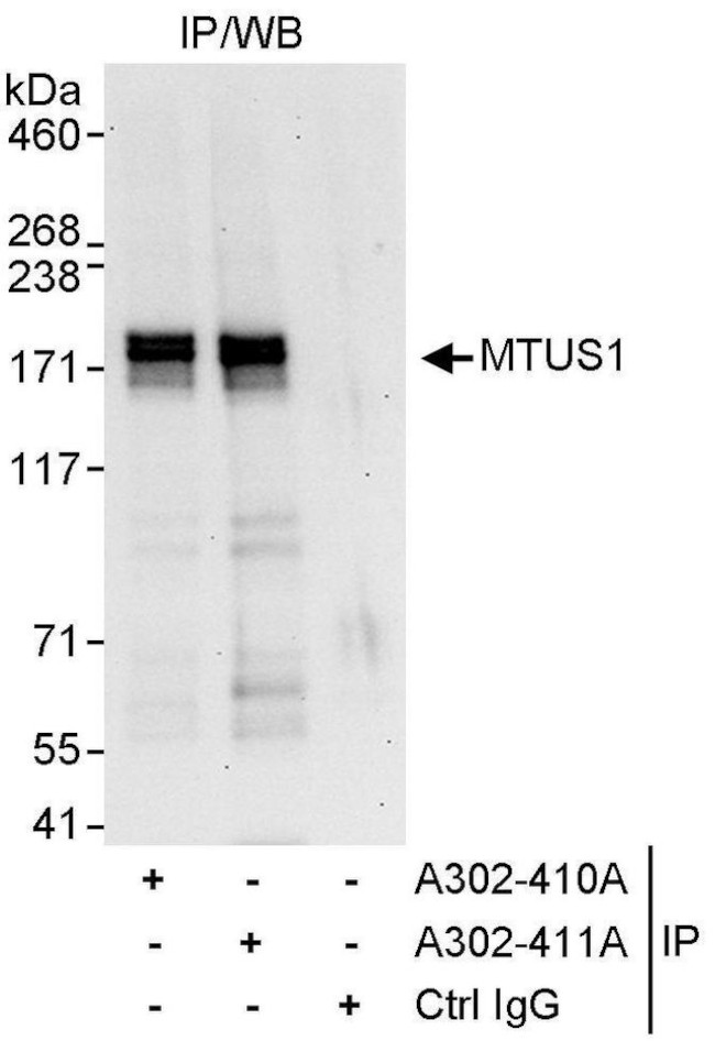 MTUS1 Antibody in Immunoprecipitation (IP)