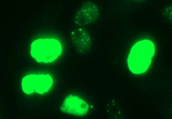 MYC Antibody in Immunocytochemistry (ICC/IF)