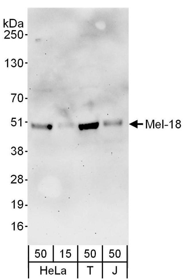 Mel-18 Antibody in Western Blot (WB)