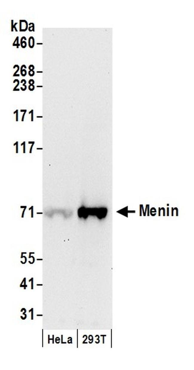 Menin Antibody in Western Blot (WB)