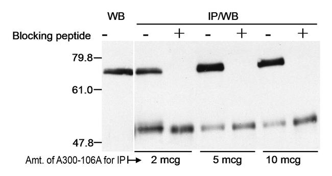 Menin Antibody in Western Blot (WB)