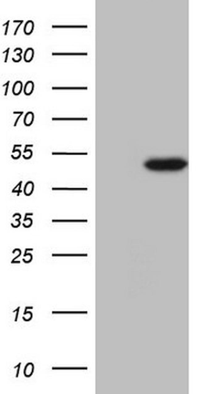 NARS2 Antibody in Western Blot (WB)