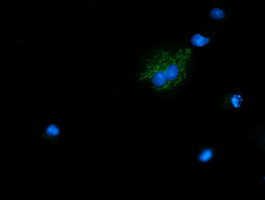 NDUFB10 Antibody in Immunocytochemistry (ICC/IF)