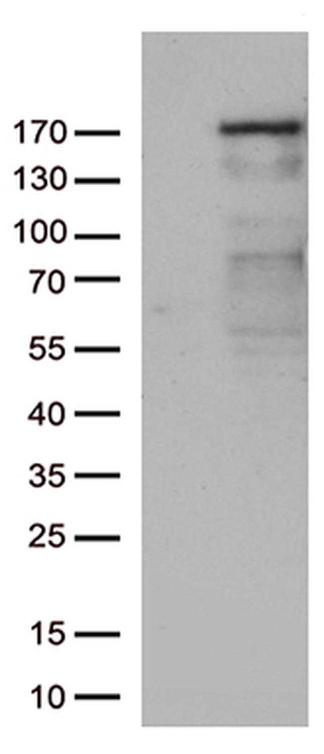 NEDD4 Antibody in Western Blot (WB)