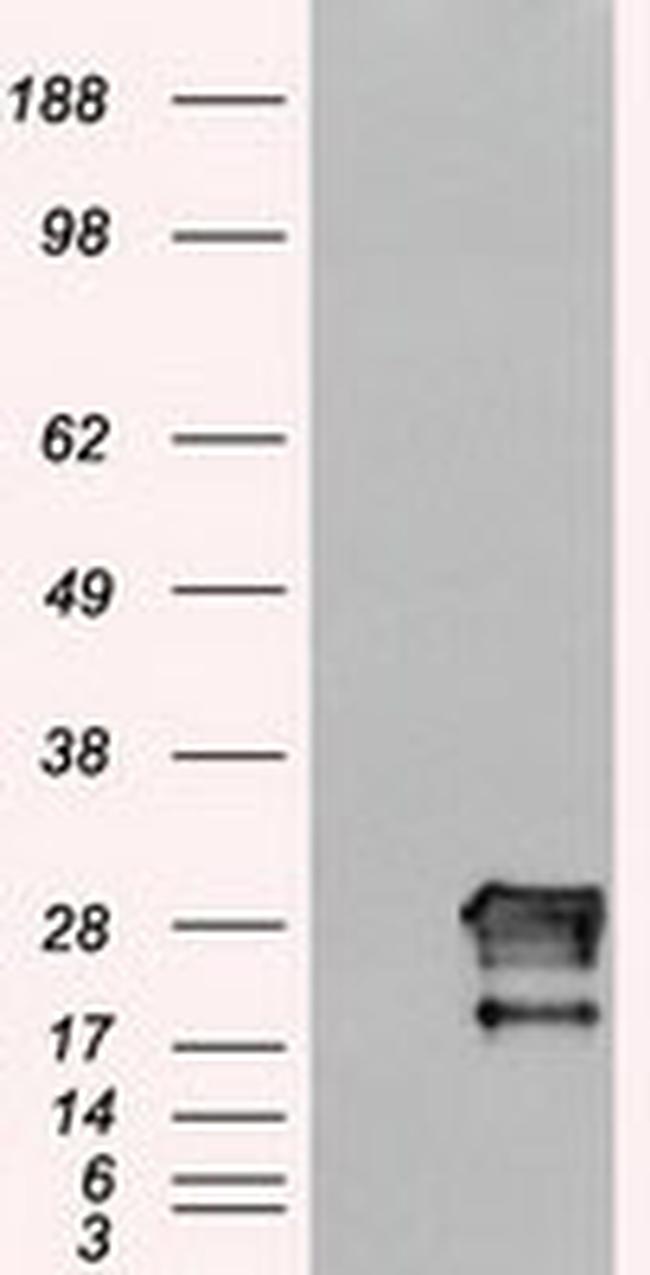 NEUROG1 Antibody in Western Blot (WB)